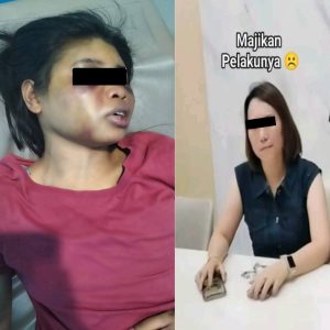 Intan Asal Sumba Bekerja Sebagai ART di Siksa Majikan di Kawasan Perumahan Elit Sukajadi